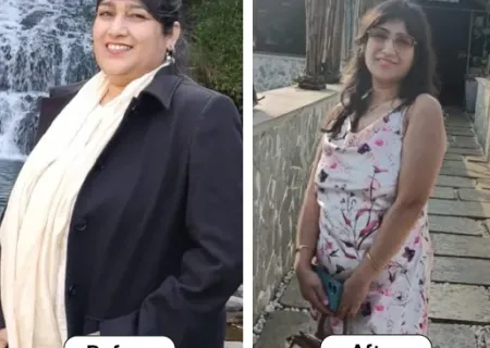 Patient Lost 18 Kg
