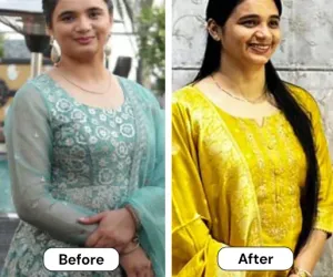 Patient Transformation