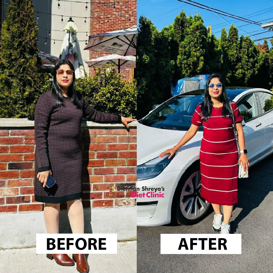 Weight Loss Transformation - Lost 12kg