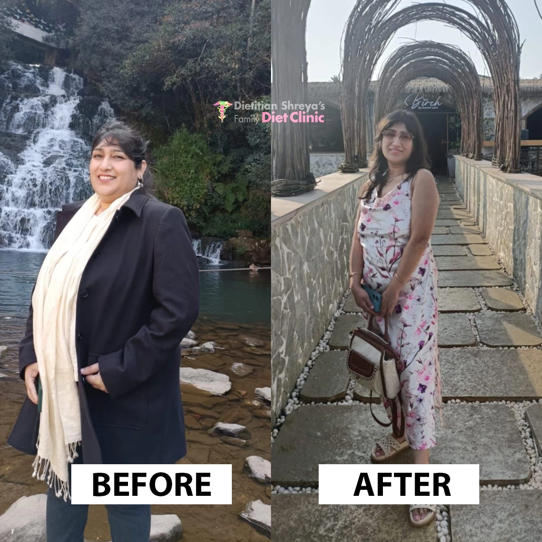 Thyroid Weight Loss Transformation - Lost 18kg